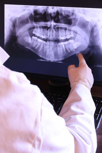 Best Emergency Treatment for Dental Infections or Abscesses in Northfield, MN